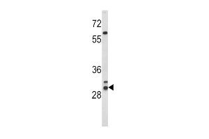 Western blot analysis of HLA-DRB1 Antibody (N-term) (ABIN390872 and ABIN2841088) in WiDr cell line lysates (35 μg/lane). (HLA-DRB1 antibody  (AA 30-58))