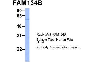 Host:  Rabbit  Target Name:  FAM134B  Sample Type:  Human Fetal Heart  Antibody Dilution:  1. (FAM134B antibody  (Middle Region))