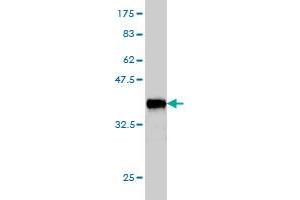 Western Blot detection against Immunogen (35. (CTF18 antibody  (AA 886-975))