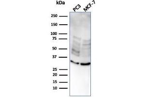 Western Blot Analysis of PC3 and MCF-7 cell lysate usingNKX2. (NKX2-8 antibody  (AA 10-123))