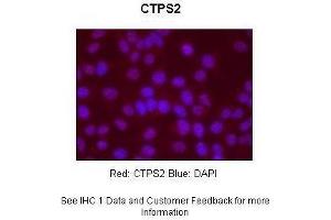 Sample Type : Human Hep-2 cells Primary Antibody Dilution : 1:500 Secondary Antibody : Goat anti-rabbit-Alexa Fluor 568 Secondary Antibody Dilution : 1:400 Color/Signal Descriptions : Red: CTPS2 Blue: DAPI Gene Name : CTPS2 Submitted by : S. (CTPS2 antibody  (N-Term))