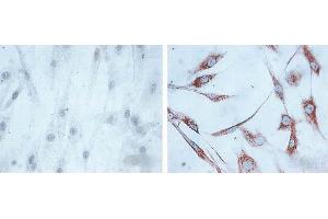 IHC of human skin fibroblasts (Left: control, Right: 24 hours after 7th passage of senescence). (HSPD1 antibody)