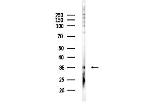 anti-G Protein-Coupled Receptor 35 (GPR35) (Internal Region) antibody