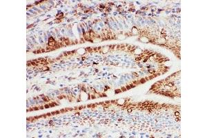 Immunohistochemistry (IHC) image for anti-Heat Shock 105kDa/110kDa Protein 1 (HSPH1) (AA 713-733) antibody (ABIN3031140)
