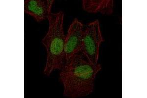 Immunofluorescence analysis of HeLa cells using MAP2K7 monoclonal antibody, clone 4E5  (green). (MAP2K7 antibody)