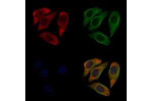 ABIN6258888 and ABIN6274835 staining Hela cells by IF/ICC. (SGCA antibody  (Internal Region))