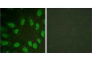 Immunofluorescence analysis of HeLa cells, using AML1 (Ab-303) Antibody. (RUNX1 antibody  (AA 269-318))