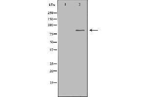 Western blot analysis of extracts of colo , using CHAT antibody. (Choline Acetyltransferase antibody  (C-Term))