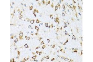 Immunohistochemistry of paraffin-embedded Mouse brain using NRG4 Polyclonal Antibody at dilution of 1:100 (40x lens). (Neuregulin 4 antibody)