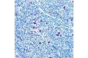 Immunohistochemistry of paraffin-embedded mouse spleen using FGF21 Rabbit mAb (ABIN1680154, ABIN3018263, ABIN3018264 and ABIN7101589) at dilution of 1:100 (40x lens).