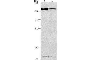 Western blot analysis of Lovo cell and human fetal brain tissue, using ADCY3 Polyclonal Antibody at dilution of 1:312. (ADCY3 antibody)