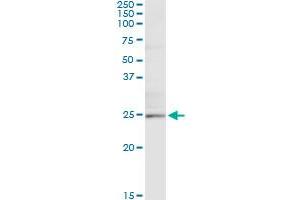 Immunoprecipitation of TWIST1 transfected lysate using anti-TWIST1 monoclonal antibody and Protein A Magnetic Bead , and immunoblotted with TWIST1 MaxPab rabbit polyclonal antibody. (TWIST1 antibody  (AA 106-174))