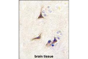 Formalin-fixed and paraffin-embedded human brain tissue reacted with NGFB antibody , which was peroxidase-conjugated to the secondary antibody, followed by DAB staining. (NGFB antibody  (AA 84-115))