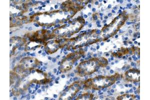 IHC analysis of Ca4 using anti-Ca4 antibody (ABIN7600898).