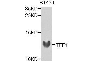 Western blot analysis of extracts of BT-474 cells, using TFF1 antibody. (TFF1 antibody)