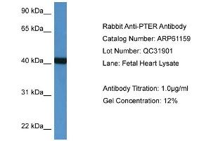 Western Blotting (WB) image for anti-Phosphotriesterase Related (PTER) (N-Term) antibody (ABIN2788700) (PTER antibody  (N-Term))