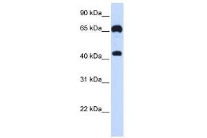 GUCY1B3 antibody used at 1 ug/ml to detect target protein. (GUCY1B3 antibody  (N-Term))
