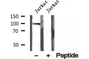 Western blot analysis of extracts of Jurkat cells, using NOD2 antibody. (NOD2 antibody  (N-Term))