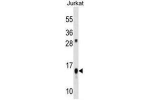 ATP5D Antibody (C-term) western blot analysis in Jurkat cell line lysates (35µg/lane). (ATP5F1D antibody  (C-Term))