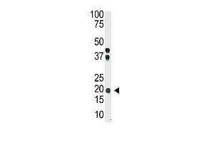 The anti-IL28 Ctr-term Pab (ABIN388445 and ABIN2848736) is used in Western blot to detect IL28 in mouse brain tissue lysate. (IL-28 antibody  (AA 61-92))