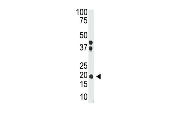 IL-28 antibody  (AA 61-92)