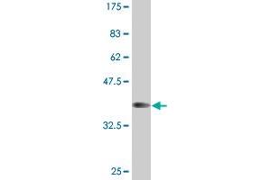 Western Blot detection against Immunogen (37. (HOXB1 antibody  (AA 101-210))