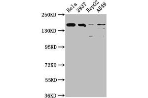 Western Blot Positive WB detected in: Hela whole cell lysate, 293T whole cell lysate, HepG2 whole cell lysate, A549 whole cell lysate All lanes: BRD4 antibody at 1:1500 Secondary Goat polyclonal to rabbit IgG at 1/50000 dilution Predicted band size: 153, 81, 89 kDa Observed band size: 153 kDa (Recombinant BRD4 antibody)