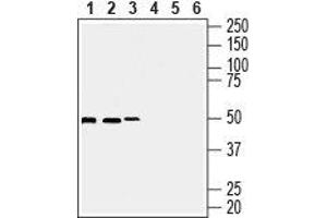 Western blot analysis of human Burkitt's lymphoma Daudi (lanes 1 and 3), human T-cell leukemia Jurkat (lanes 2 and 5) and human breast adenocarcinoma MCF-7 cell lysates (lanes 3 and 6): - 1-3. (Septin 7 antibody  (Intracellular))