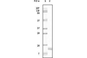 Western Blotting (WB) image for anti-Synuclein, gamma (Breast Cancer-Specific Protein 1) (SNCG) (truncated) antibody (ABIN2464104) (SNCG antibody  (truncated))