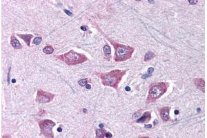 Brain, cortex (MCOLN1 antibody  (AA 101-150))