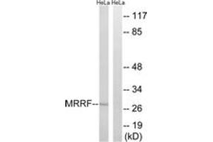 Western blot analysis of extracts from HeLa cells, using MRRF Antibody. (MRRF antibody  (AA 181-230))