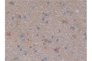 NFkB antibody  (AA 805-892)
