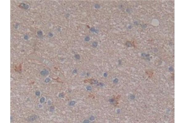 NFkB antibody  (AA 805-892)