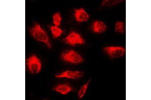 Immunofluorescent analysis of A20 staining in HeLa cells. (IGKV1-27 antibody  (Center))