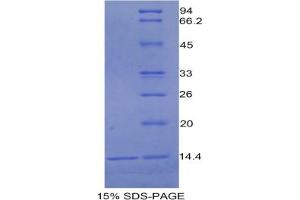 SDS-PAGE analysis of Rat Urocortin 1 Protein. (Urocortin 1 Protein (UCN1))