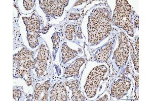 IHC analysis of C1orf77/FOP/CHTOP using anti-C1orf77/FOP/CHTOP antibody (ABIN7603201).