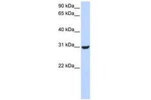Image no. 1 for anti-Ring Finger Protein 182 (RNF182) (AA 144-193) antibody (ABIN6740825)