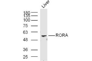 Mouse liver lysates probed with RORA Polyclonal Antibody, Unconjugated  at 1:300 in 4˚C overnight.