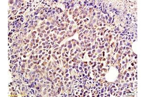 Immunohistochemistry (Paraffin-embedded Sections) (IHC (p)) image for anti-Insulin-Degrading Enzyme (IDE) (AA 491-590) antibody (ABIN723680)