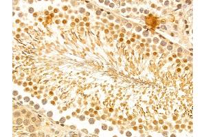 ABIN7094244 and ABIN7098291 at 1/100 staining Rat testis tissue by IHC-P. (FZR1 antibody  (Internal Region))