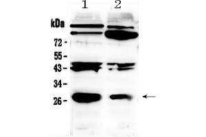 Western blot analysis of PDGF beta using anti- PDGF beta antibody . (PDGFB antibody  (C-Term))