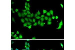 Immunofluorescence analysis of A549 cells using HSPA14 Polyclonal Antibody (HSPA14 antibody)