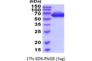 SDS-PAGE (SDS) image for Placental Alkaline Phosphatase (ALPP) (AA 23-506) (Active) protein (His tag) (ABIN7529299)