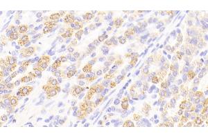 Detection of REG3a in Human Stomach Tissue using Polyclonal Antibody to Regenerating Islet Derived Protein 3 Alpha (REG3a) (REG3A antibody  (AA 40-164))