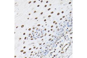 Immunohistochemistry of paraffin-embedded human esophageal using Histone H1t Rabbit pAb (ABIN7267716) at dilution of 1:100 (40x lens). (Histone H1 antibody  (AA 150-207))