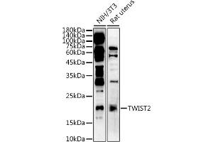 Western blot analysis of extracts of various cell lines, using  at 1:500 dilution. (TWIST2 antibody  (AA 1-70))