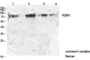 Western Blotting (WB) image for anti-Forkhead Box P1 (FOXP1) (C-Term) antibody (ABIN3178244) (FOXP1 antibody  (C-Term))