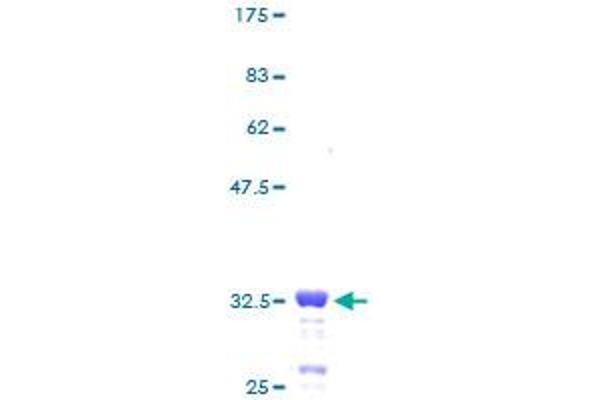 RPS29 Protein (AA 1-56) (GST tag)