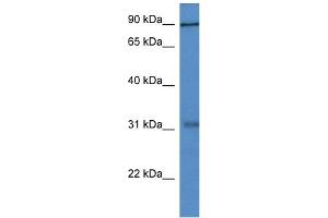 WB Suggested Anti-Mid2 Antibody   Titration: 1.