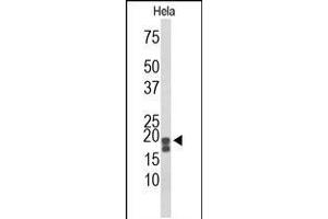 Western blot analysis of ACP1 Antibody in Hela cell line lysates (35ug/lane) (ACP1 antibody  (N-Term))